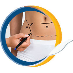 Mamoplastia redutora