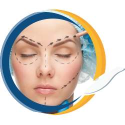 Mamoplastia redutora